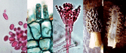 Fungi and mould can co-habit in your car's air conditioning unit, quietly multiplying in the moist atmosphere causing unhealthy and very unpleasant odours to develop.